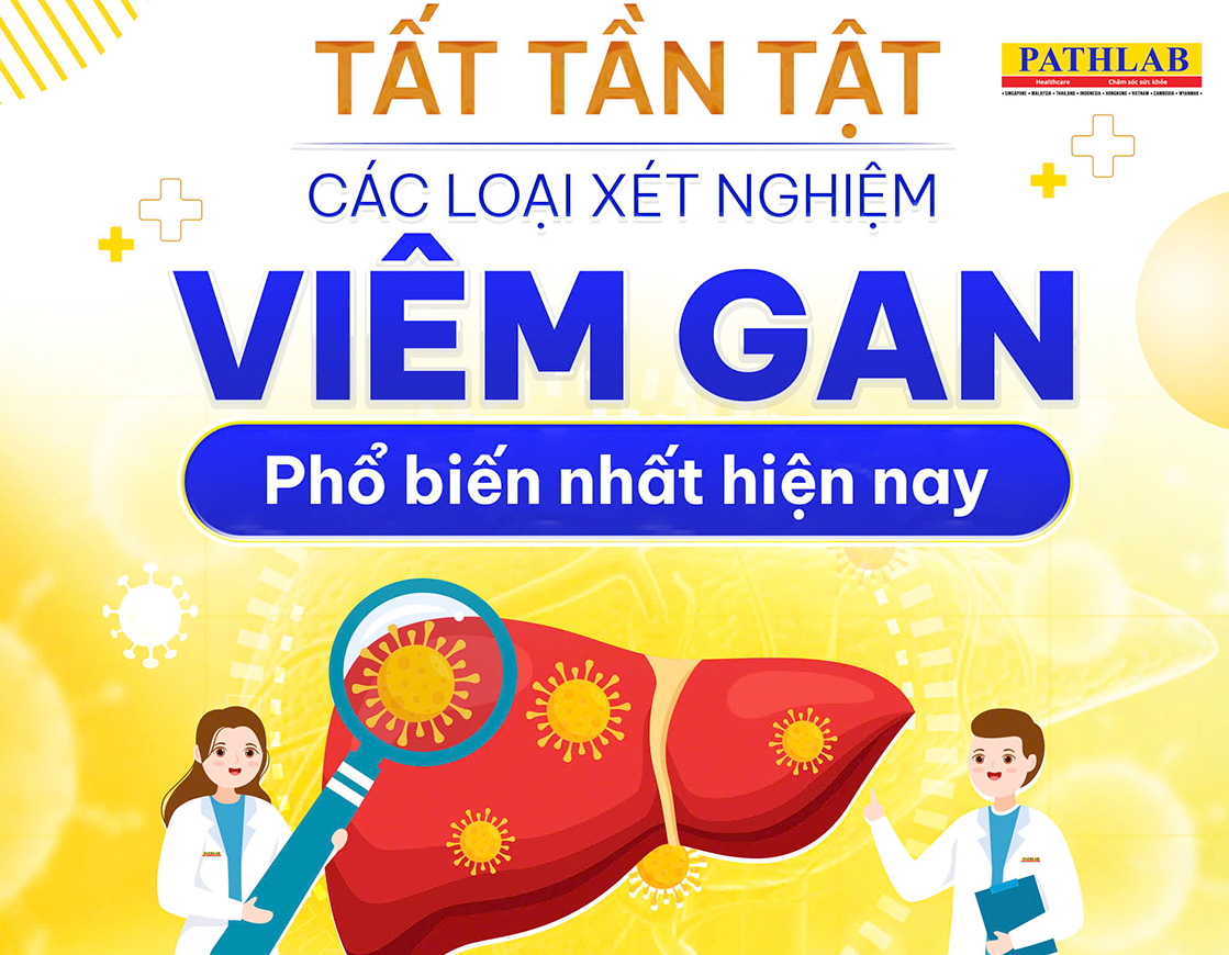 xet-nghiem-viem-gan