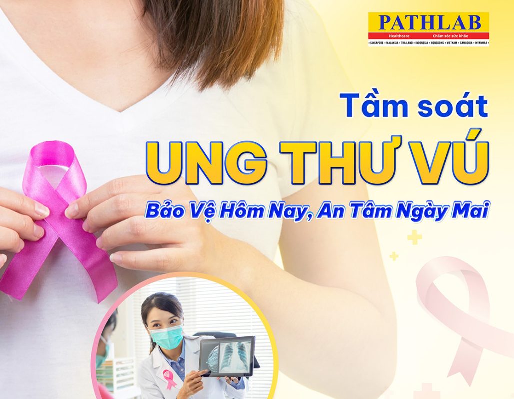 tầm soát ung thư vú