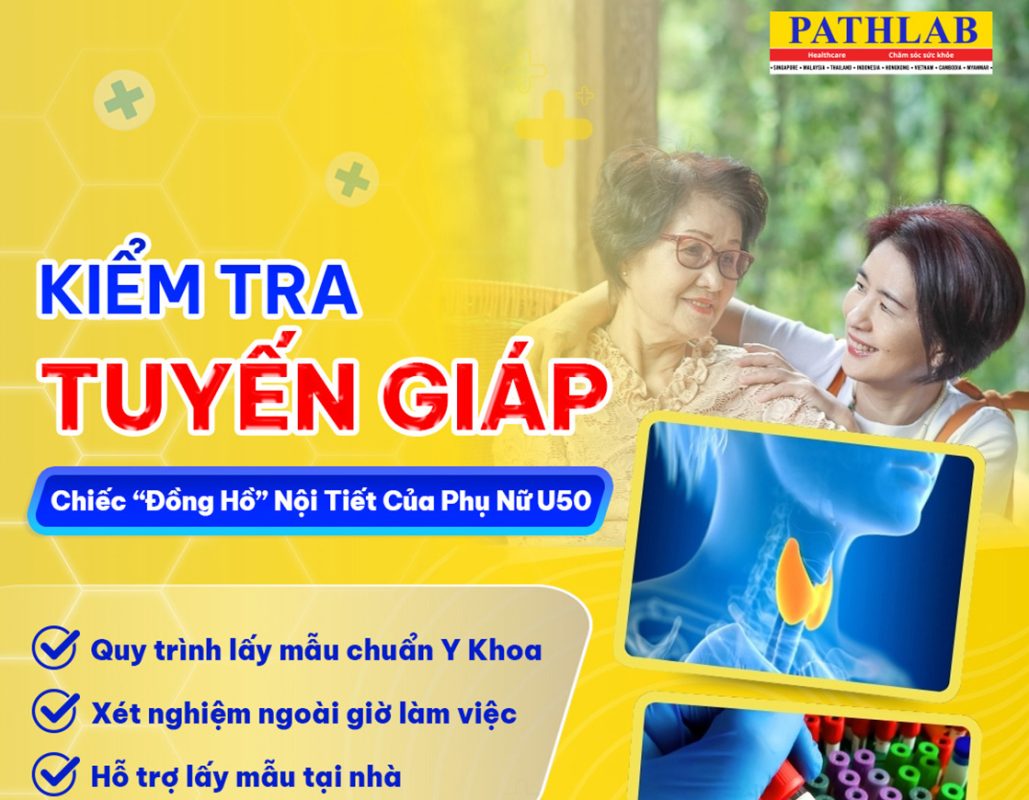 Xét nghiệm tuyến giáp cho phụ nữ U50