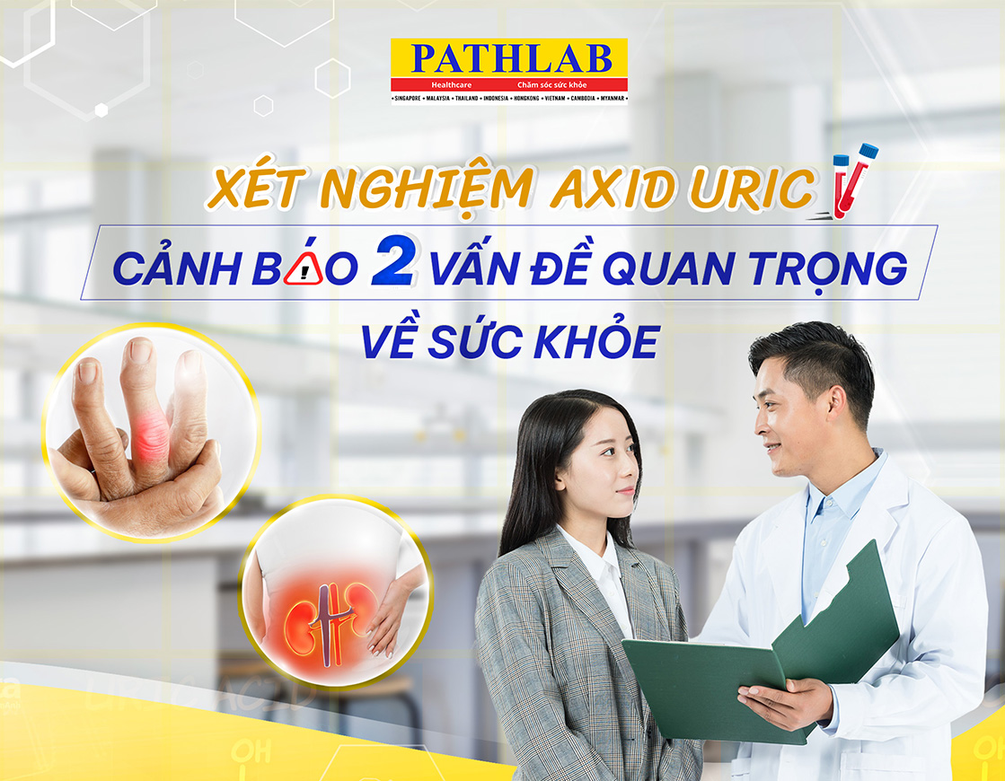 xét nghiệm axit uric