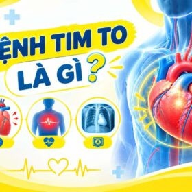 bệnh tim to