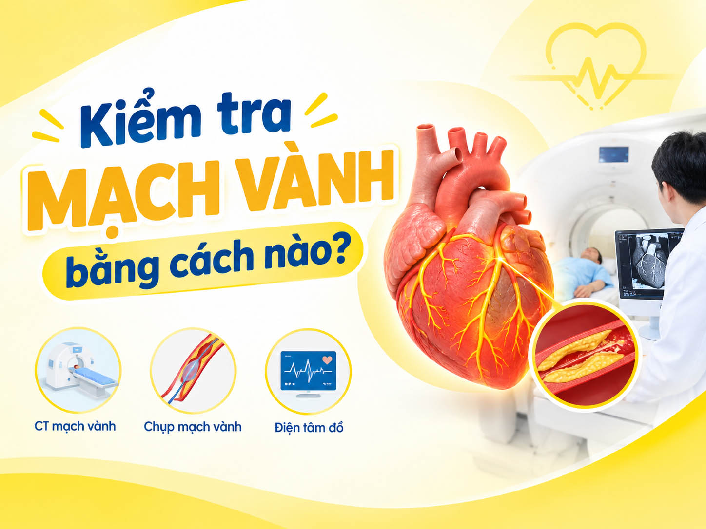kiểm tra mạch vành