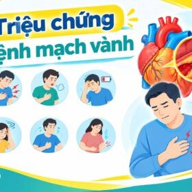 triệu chứng bệnh mạch vành
