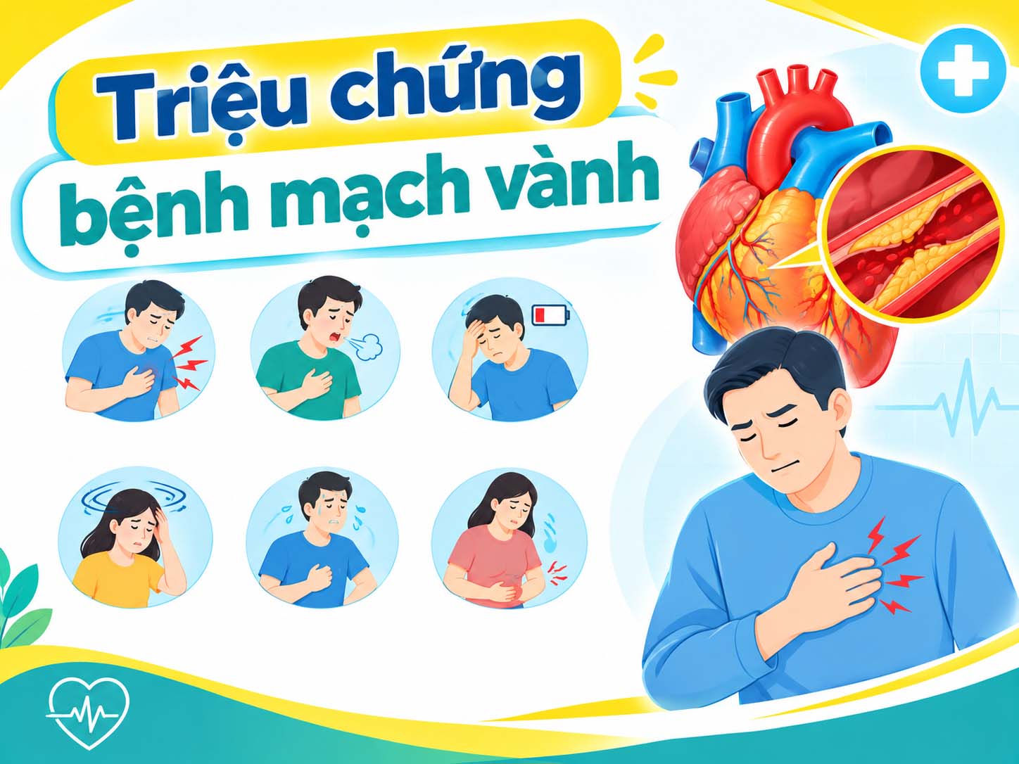 triệu chứng bệnh mạch vành